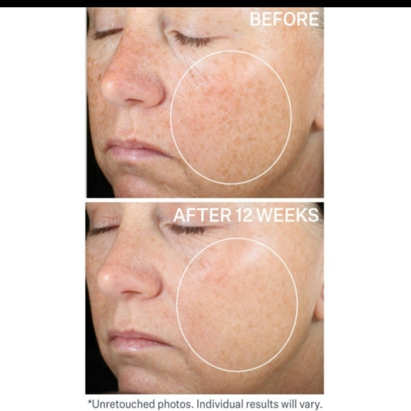 StriVectin Super-C Retinol Brighten & Correct Vitamin C Serum - Picture 3 of 8